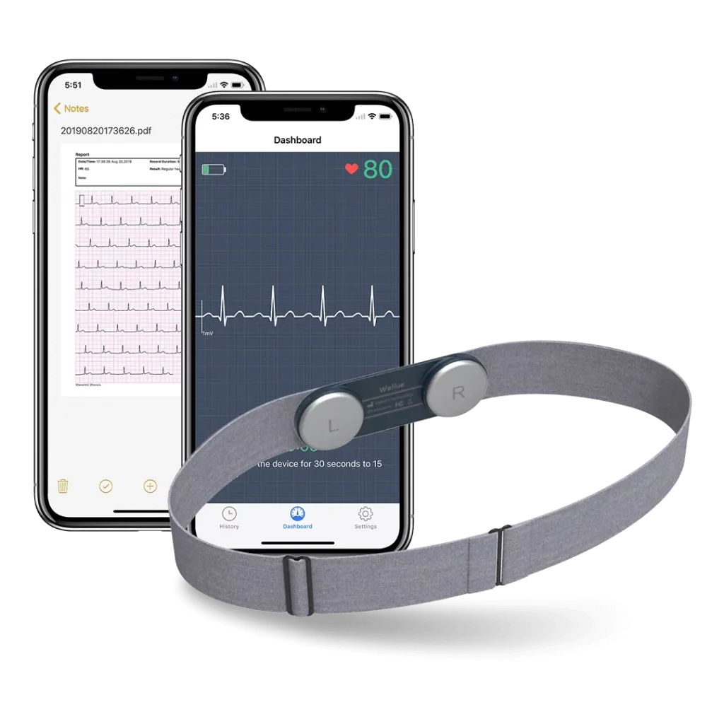 wearable ECG monitor